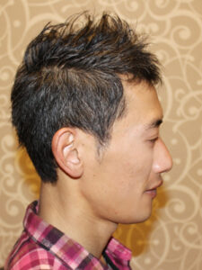 アクティブショート