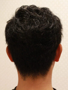 陰影を作ったバングのみ矯正