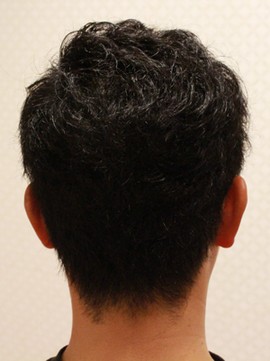 陰影を作ったバングのみ矯正