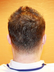 ナチュラルショート